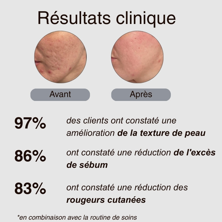 Lingettes Visage Jetable (Confort absolu)