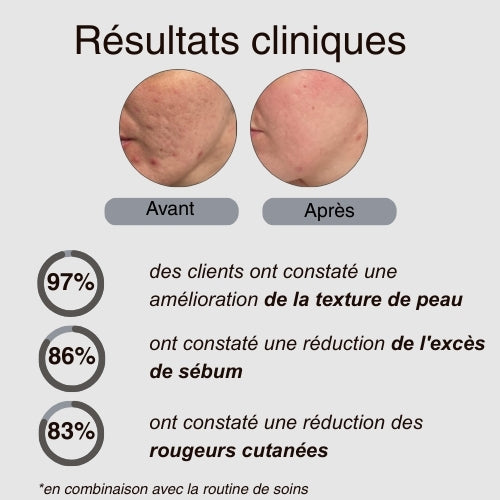 Lingettes Visage Jetable (Peau saine)